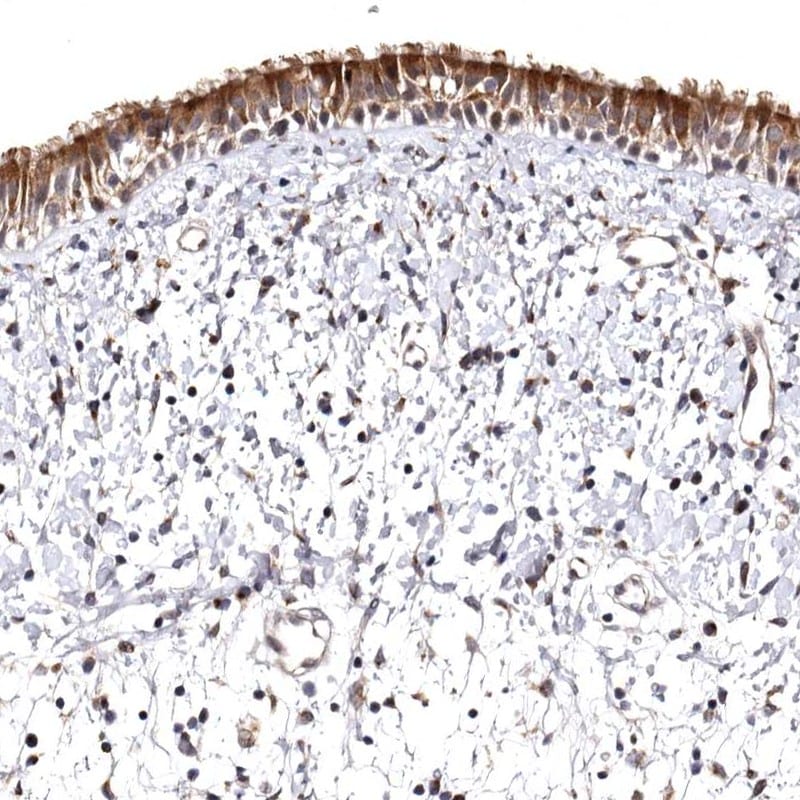 FAM91A1 Antibody - BSA Free Immunohistochemistry-Paraffin: FAM91A1 Antibody [NBP1-83576]