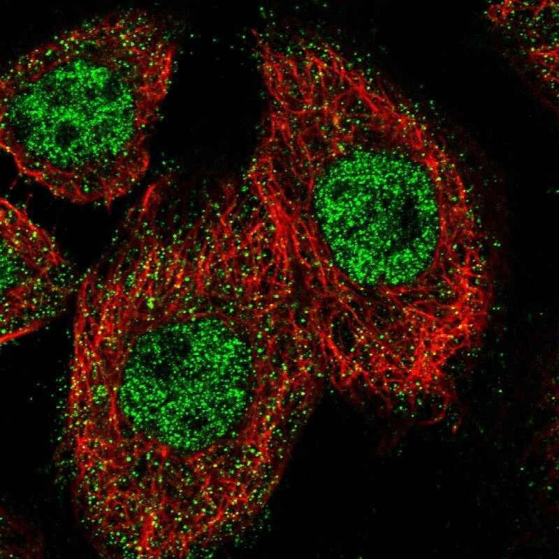 ZNF449 Antibody - BSA Free Immunocytochemistry/ Immunofluorescence: ZNF449 Antibody [NBP1-83580]