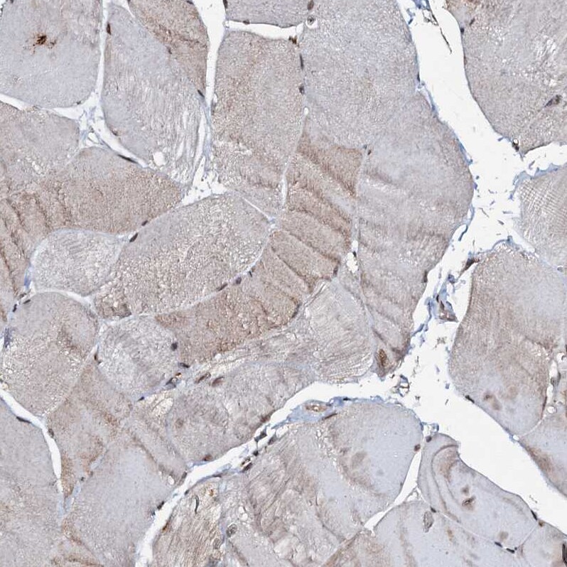 C18orf32 Antibody - BSA Free Immunohistochemistry-Paraffin: C18orf32 Antibody [NBP1-83585]