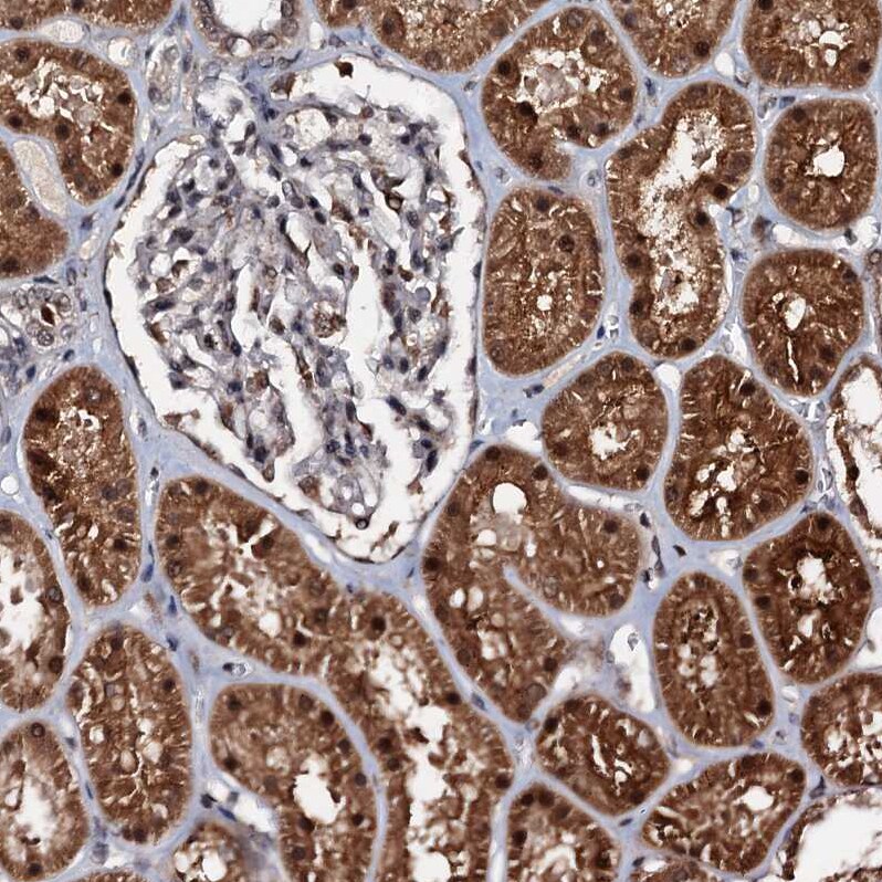 C18orf32 Antibody - BSA Free Immunohistochemistry-Paraffin: C18orf32 Antibody [NBP1-83585]