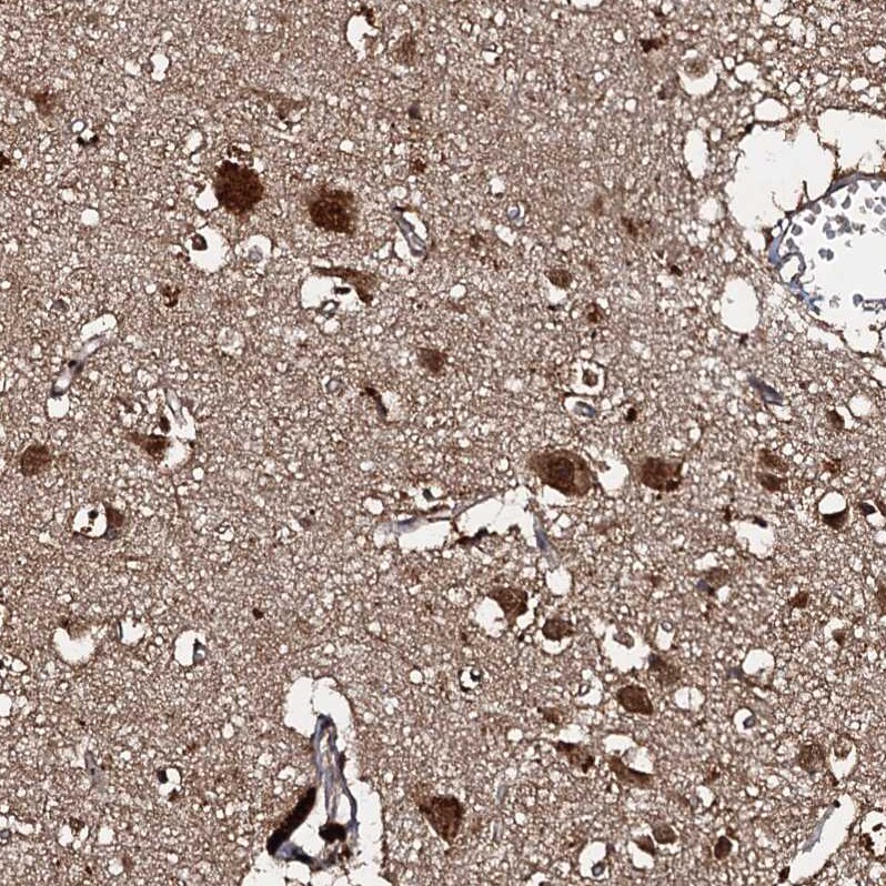 C18orf32 Antibody - BSA Free Immunohistochemistry-Paraffin: C18orf32 Antibody [NBP1-83585]