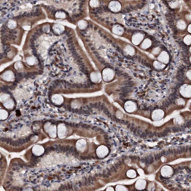 C18orf32 Antibody - BSA Free Immunohistochemistry-Paraffin: C18orf32 Antibody [NBP1-83585]