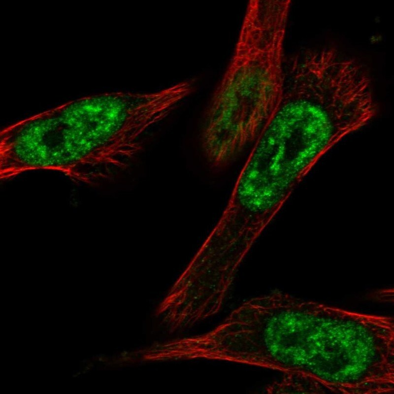 CBLL1 Antibody - BSA Free Immunocytochemistry/ Immunofluorescence: CBLL1 Antibody [NBP1-83588]