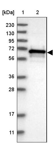 CBLL1 Antibody - BSA Free Western Blot: CBLL1 Antibody - BSA Free [NBP1-83589]