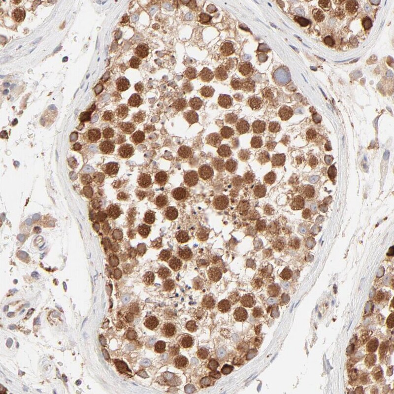 PARP12 Antibody - BSA Free Immunohistochemistry-Paraffin: PARP12 Antibody - BSA Free [NBP1-83592]
