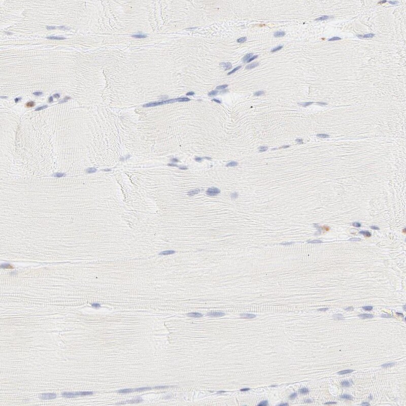 PARP12 Antibody - BSA Free Immunohistochemistry-Paraffin: PARP12 Antibody - BSA Free [NBP1-83592]