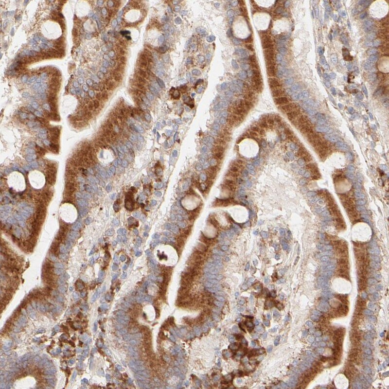 PARP12 Antibody - BSA Free Immunohistochemistry-Paraffin: PARP12 Antibody - BSA Free [NBP1-83592]