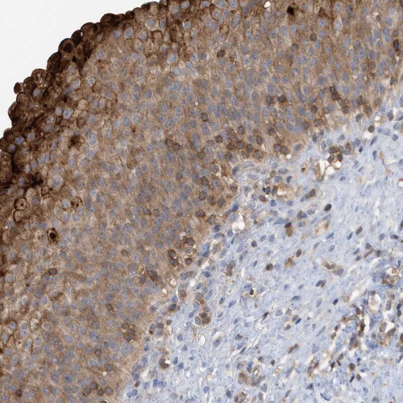 NSUN3 Antibody - BSA Free Immunohistochemistry-Paraffin: NSUN3 Antibody - BSA Free [NBP1-83595]