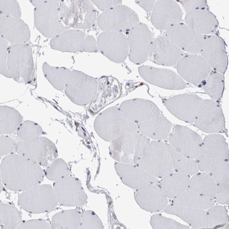 FIP1/RCP Antibody - BSA Free Immunohistochemistry-Paraffin: FIP1/RCP Antibody [NBP1-83600]