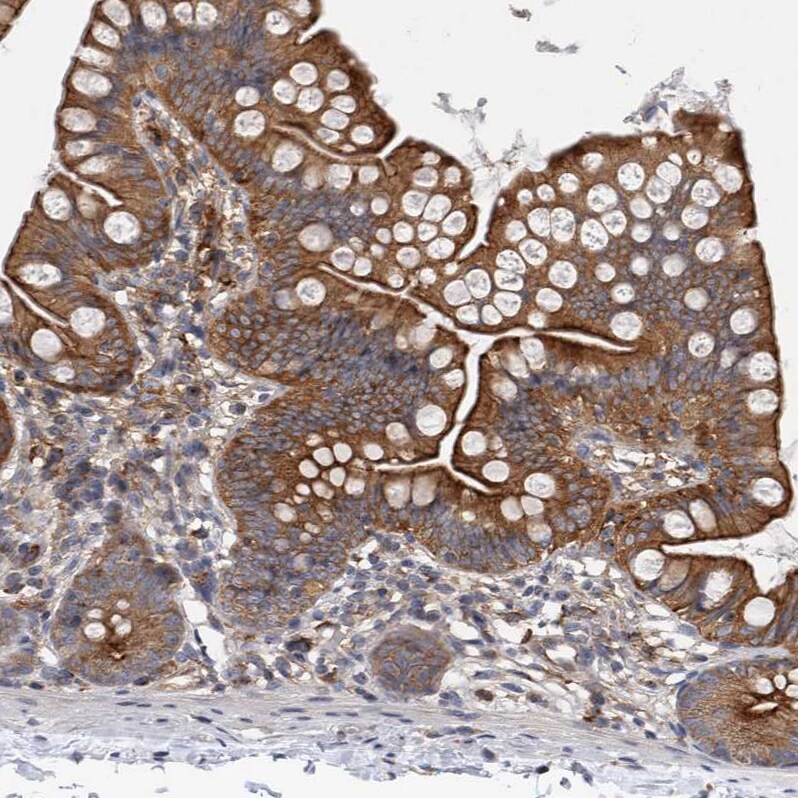 FIP1/RCP Antibody - BSA Free Immunohistochemistry-Paraffin: FIP1/RCP Antibody [NBP1-83600]