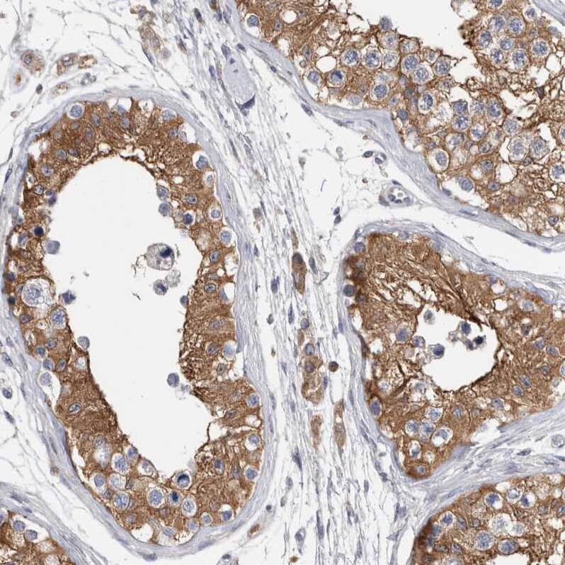 FIP1/RCP Antibody - BSA Free Immunohistochemistry-Paraffin: FIP1/RCP Antibody [NBP1-83600]