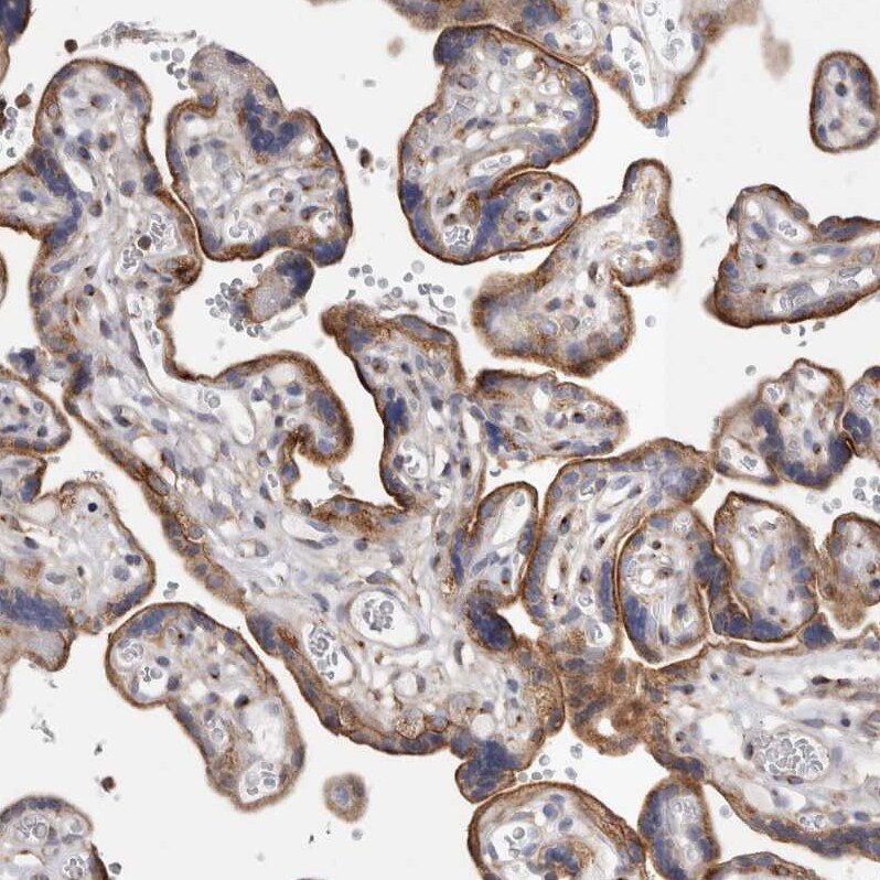 FIP1/RCP Antibody - BSA Free Immunohistochemistry-Paraffin: FIP1/RCP Antibody [NBP1-83600]