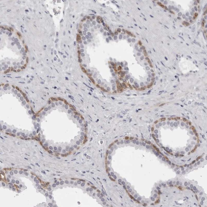 NUDT18 Antibody - BSA Free Immunohistochemistry-Paraffin: NUDT18 Antibody - BSA Free [NBP1-83602]