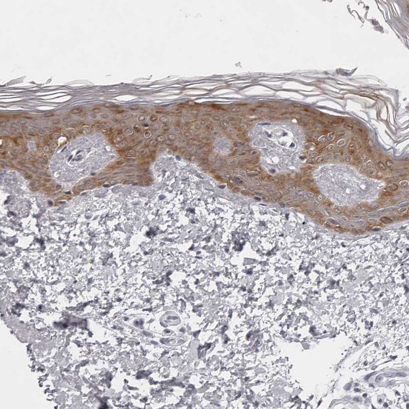NUDT18 Antibody - BSA Free Immunohistochemistry-Paraffin: NUDT18 Antibody - BSA Free [NBP1-83602]