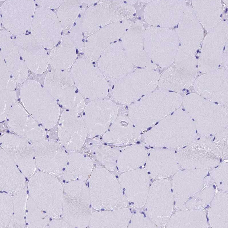 SLC24A6 Antibody - BSA Free Immunohistochemistry-Paraffin: SLC24A6 Antibody [NBP1-83607]