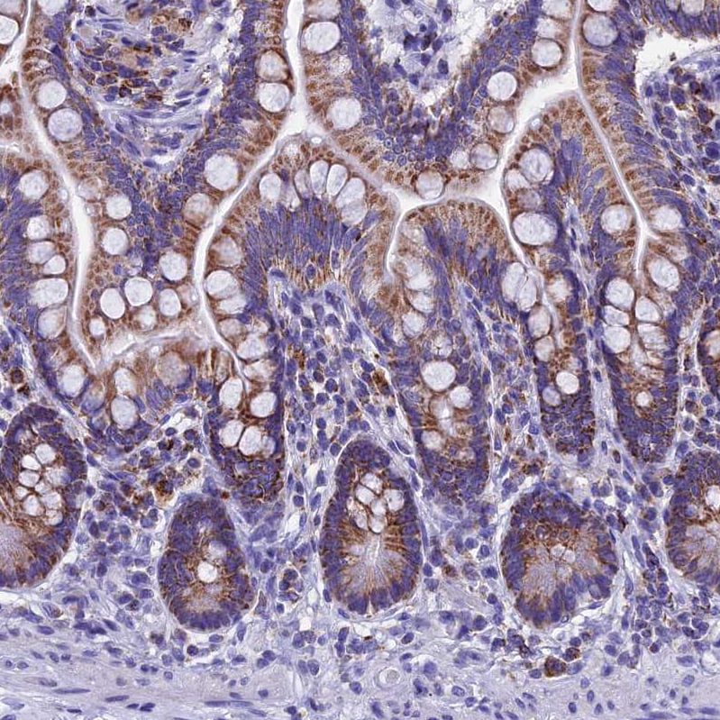 SLC24A6 Antibody - BSA Free Immunohistochemistry-Paraffin: SLC24A6 Antibody [NBP1-83607]