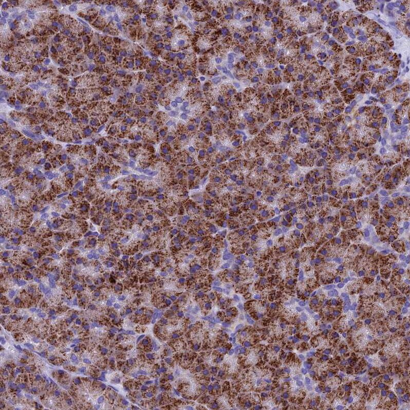 SLC24A6 Antibody - BSA Free Immunohistochemistry-Paraffin: SLC24A6 Antibody [NBP1-83607]