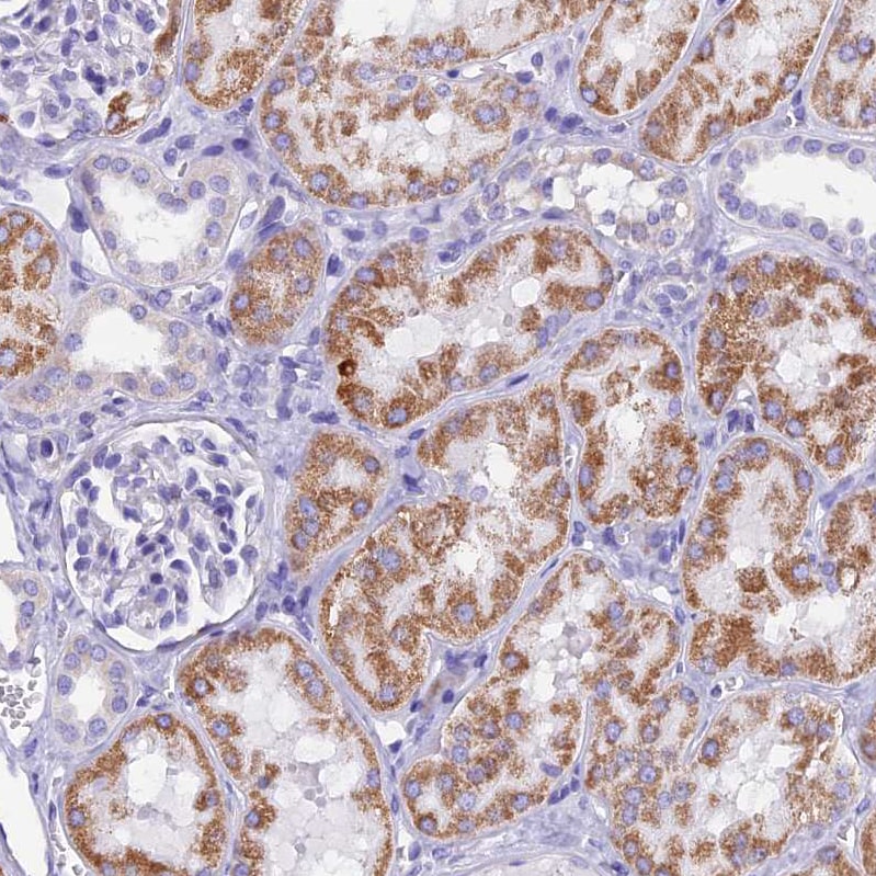 SLC24A6 Antibody - BSA Free Immunohistochemistry-Paraffin: SLC24A6 Antibody [NBP1-83607]