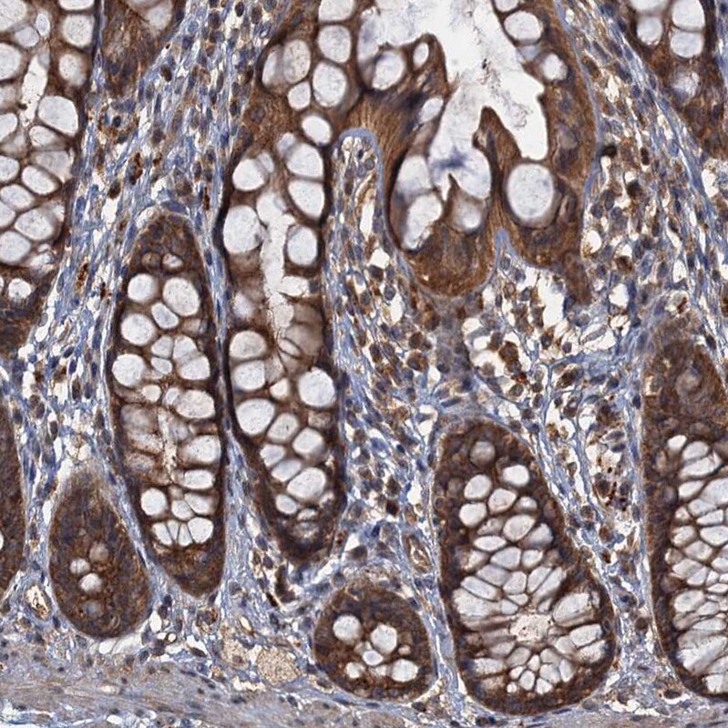 WDCP Antibody - BSA Free Immunohistochemistry-Paraffin: WDCP Antibody - BSA Free [NBP1-83612]