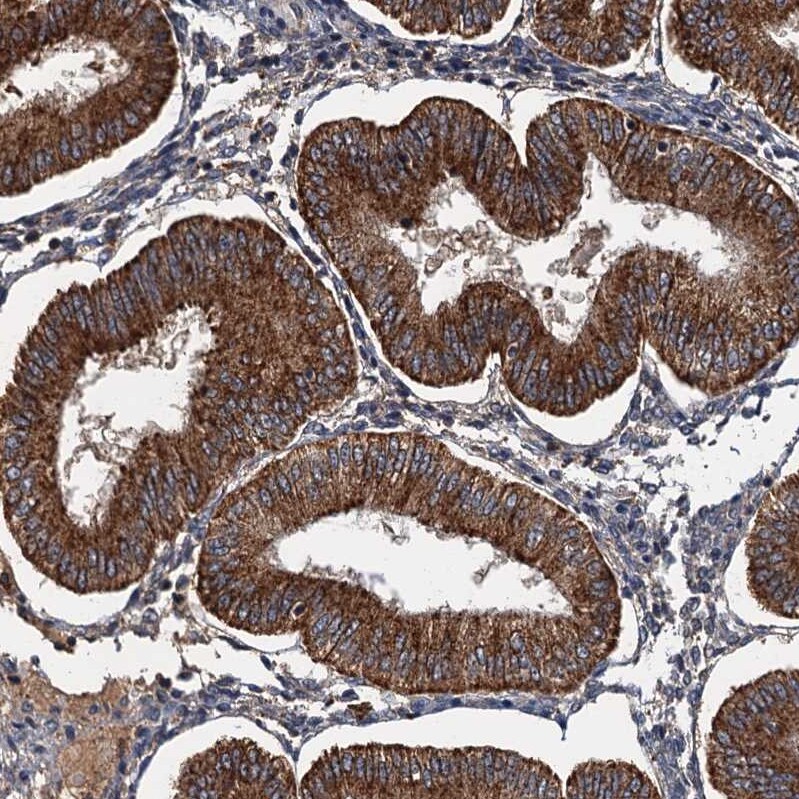 WDCP Antibody - BSA Free Immunohistochemistry-Paraffin: WDCP Antibody - BSA Free [NBP1-83612]