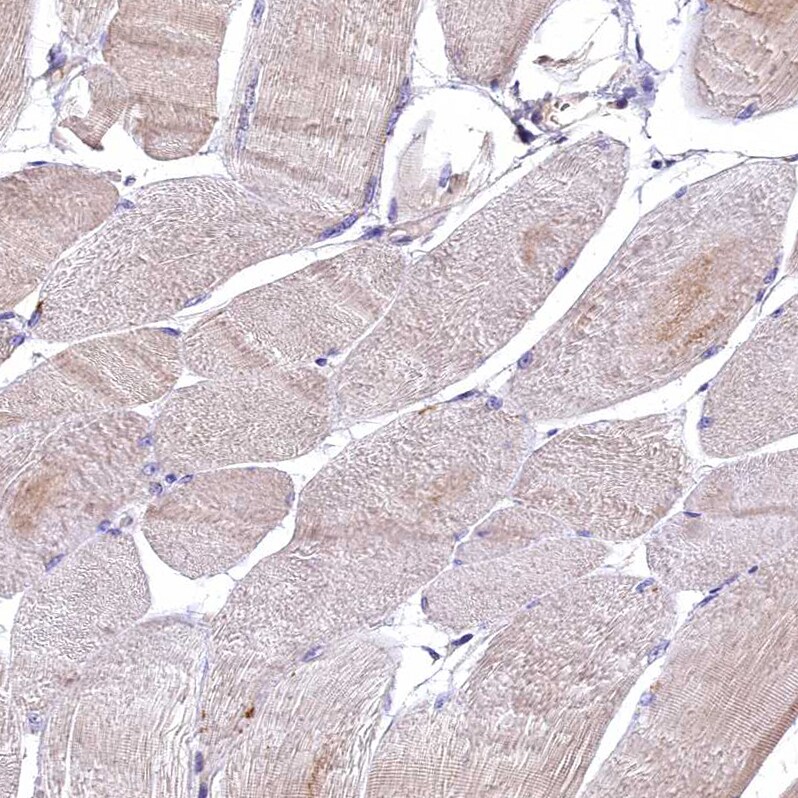 EPS8L2 Antibody - BSA Free Immunohistochemistry-Paraffin: EPS8L2 Antibody - BSA Free [NBP1-83613]