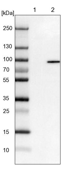 EPS8L2 Antibody - BSA Free Western Blot: EPS8L2 Antibody - BSA Free [NBP1-83613]