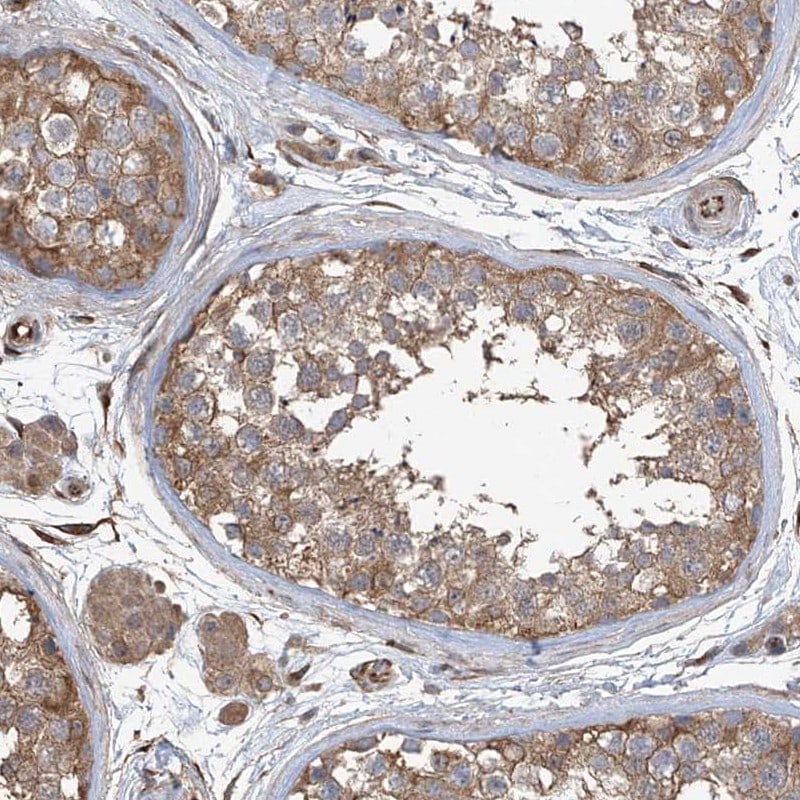 AGBL5 Antibody - BSA Free Immunohistochemistry-Paraffin: AGBL5 Antibody - BSA Free [NBP1-83616]