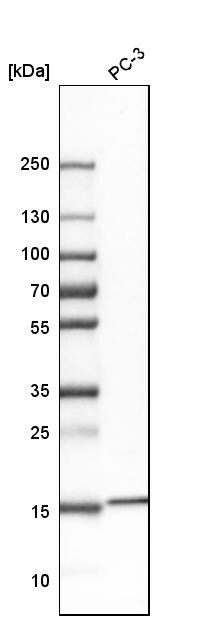 RPS19BP1 Antibody - BSA Free Western Blot: RPS19BP1 Antibody - BSA Free [NBP1-83617]