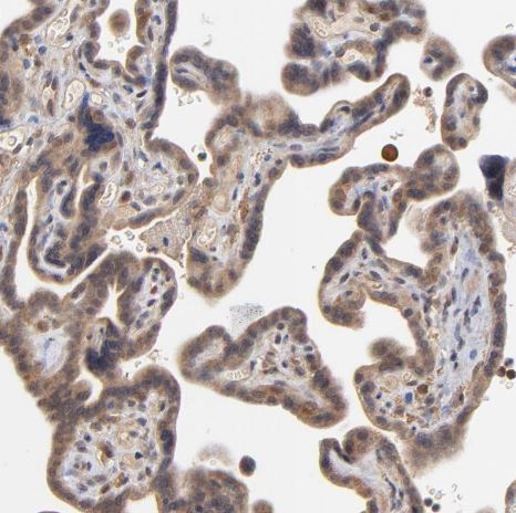 ASB8 Antibody ASB8 Antibody