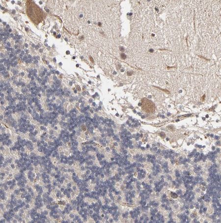 ASB8 Antibody ASB8 Antibody
