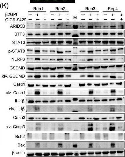 ARID5B Antibody - BSA Free