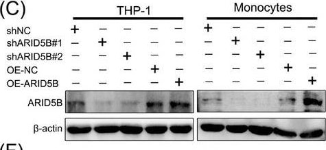 ARID5B Antibody - BSA Free