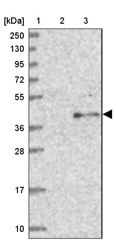 TCTN1 Antibody - BSA Free Western Blot: TCTN1 Antibody - BSA Free [NBP1-83623]