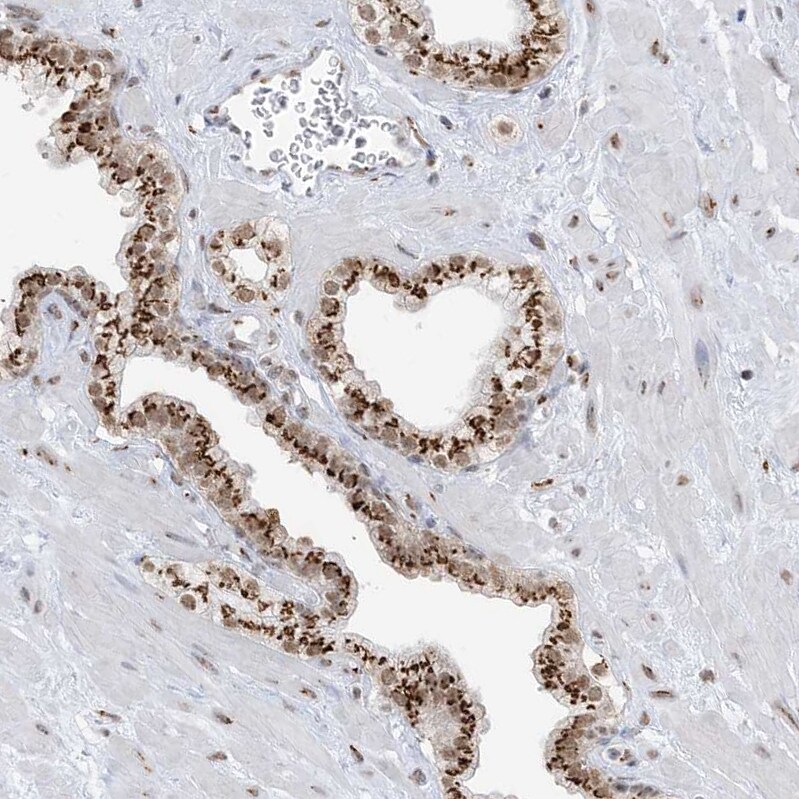 GPR107 Antibody - BSA Free Immunohistochemistry-Paraffin: GPR107 Antibody - BSA Free [NBP1-83629]