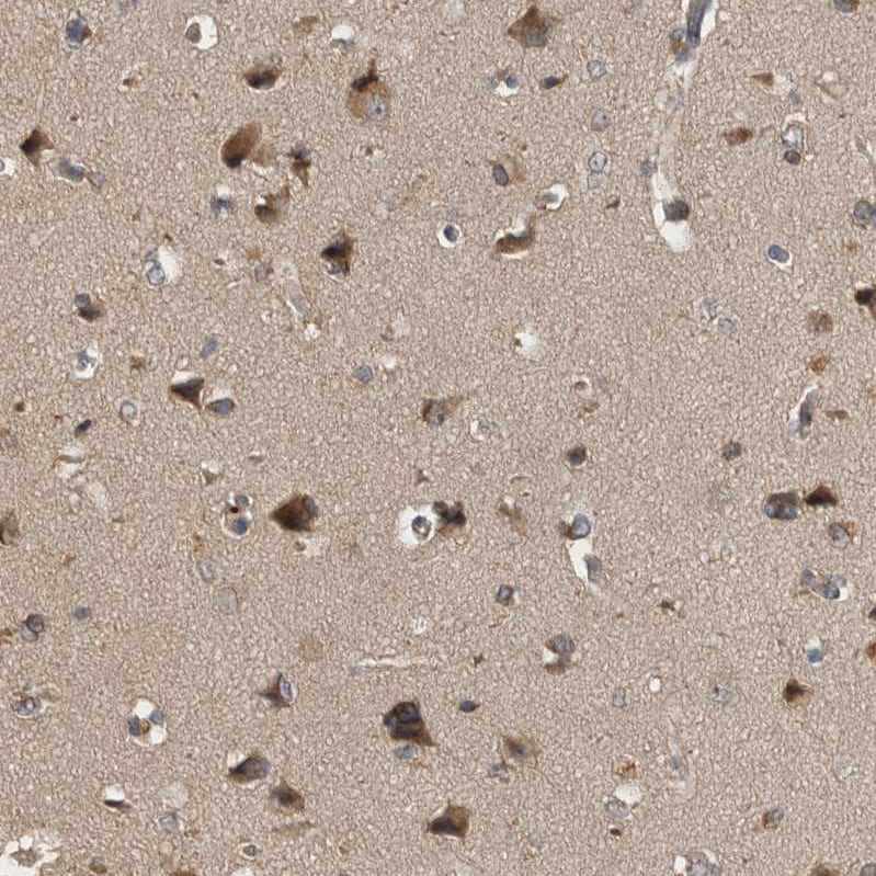 TRMT61B Antibody - BSA Free Immunohistochemistry-Paraffin: TRMT61B Antibody - BSA Free [NBP1-83640]