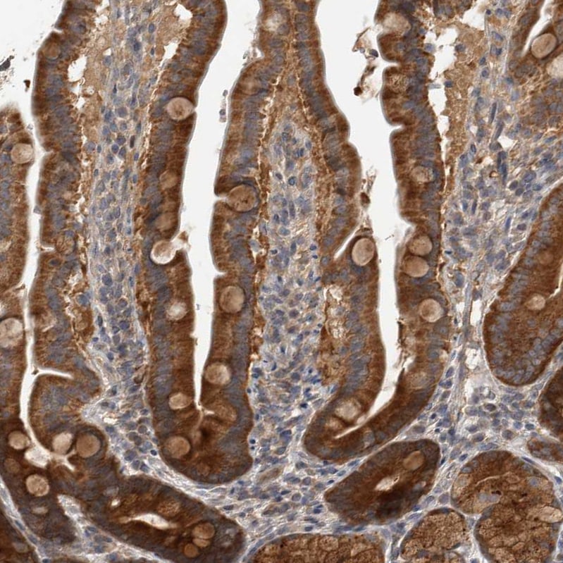 TRMT61B Antibody - BSA Free Immunohistochemistry-Paraffin: TRMT61B Antibody - BSA Free [NBP1-83640]