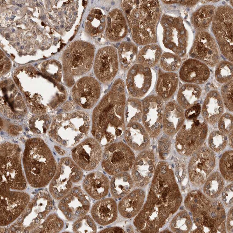 TRMT61B Antibody - BSA Free Immunohistochemistry-Paraffin: TRMT61B Antibody - BSA Free [NBP1-83640]