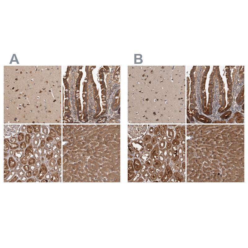TRMT61B Antibody Immunohistochemistry-Paraffin: TRMT61B Antibody Antibody [NBP1-83641]