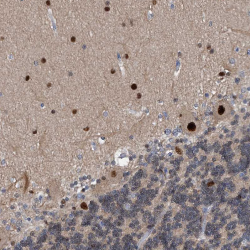 PINX1 Antibody - BSA Free Immunohistochemistry-Paraffin: PINX1 Antibody - BSA Free [NBP1-83643]