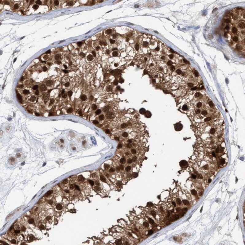 PINX1 Antibody - BSA Free Immunohistochemistry-Paraffin: PINX1 Antibody - BSA Free [NBP1-83643]