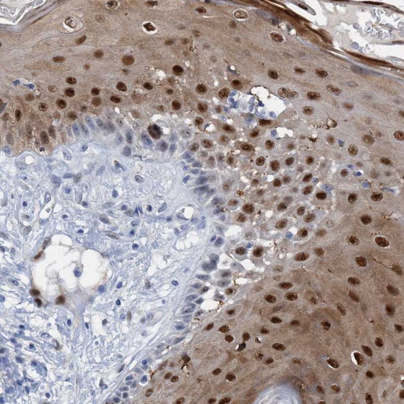 PINX1 Antibody - BSA Free Immunohistochemistry-Paraffin: PINX1 Antibody - BSA Free [NBP1-83643]
