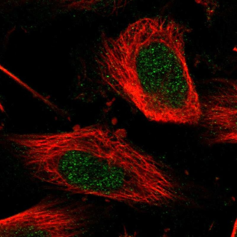 PUS7 Antibody - BSA Free Immunocytochemistry/ Immunofluorescence: PUS7 Antibody - BSA Free [NBP1-83652]