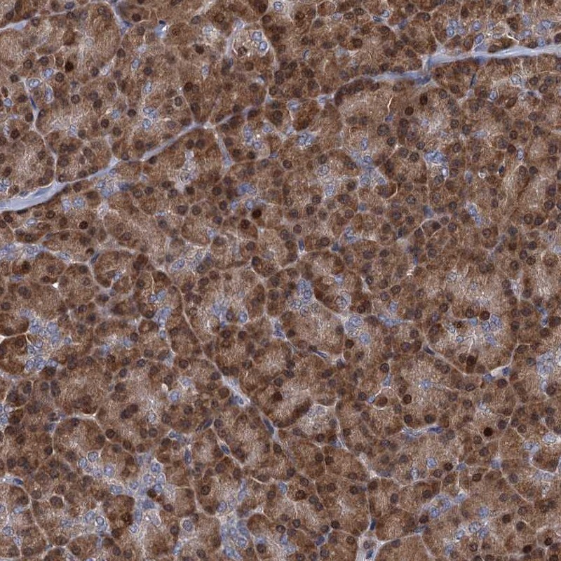 RNF125 Antibody - BSA Free Immunohistochemistry: RNF125 Antibody - BSA Free [NBP1-83653]