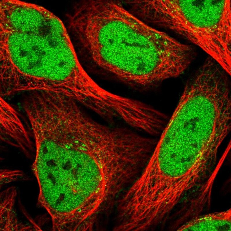 ZNF326 Antibody - BSA Free Immunocytochemistry/ Immunofluorescence: ZNF326 Antibody [NBP1-83658]