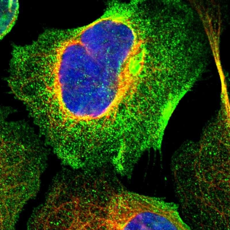 LAX1 Antibody - BSA Free Immunocytochemistry/ Immunofluorescence: LAX1 Antibody [NBP1-83661]