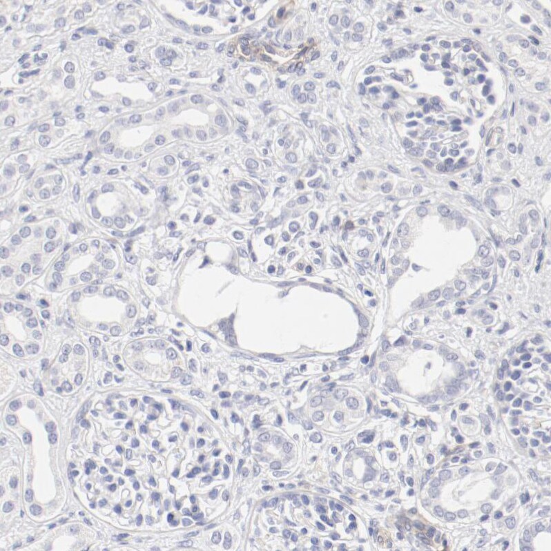 LAX1 Antibody - BSA Free Immunohistochemistry-Paraffin: LAX1 Antibody - BSA Free [NBP1-83661]