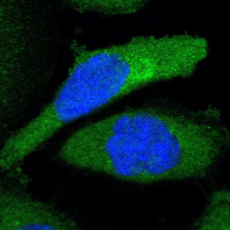 LAX1 Antibody - BSA Free Immunocytochemistry/ Immunofluorescence: LAX1 Antibody [NBP1-83662]