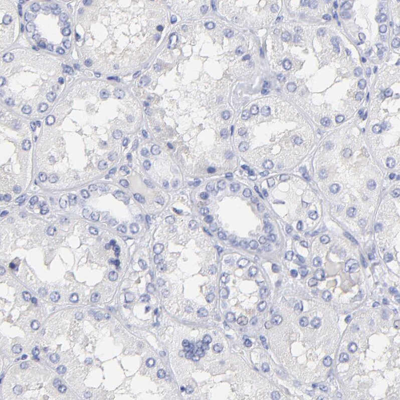 LAX1 Antibody - BSA Free Immunohistochemistry-Paraffin: LAX1 Antibody - BSA Free [NBP1-83662]
