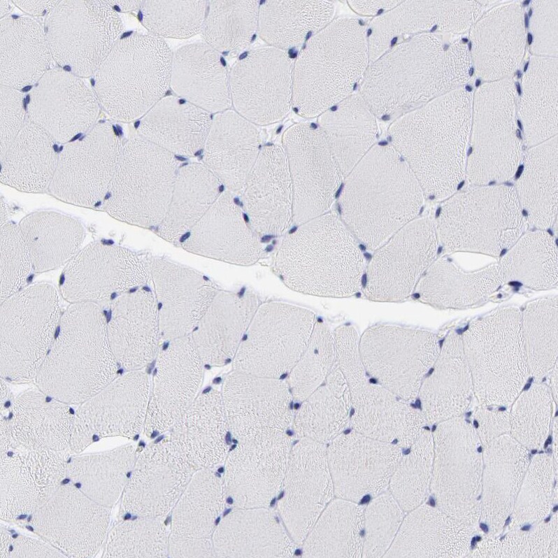 LAX1 Antibody - BSA Free Immunohistochemistry-Paraffin: LAX1 Antibody - BSA Free [NBP1-83662]