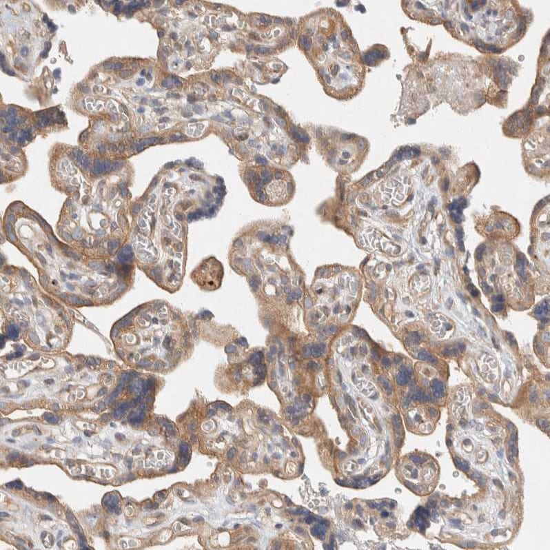 PXK Antibody - BSA Free Immunohistochemistry-Paraffin: PXK Antibody - BSA Free [NBP1-83663]